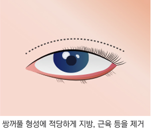 쌍꺼풀 1단계