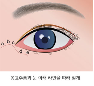 Skin Redraping(피부 재배치) 방법 1단계