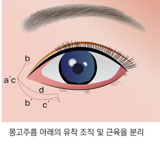 Skin Redraping(피부 재배치) 방법 2단계